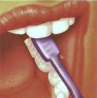 tooth2