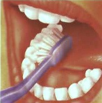 tooth4